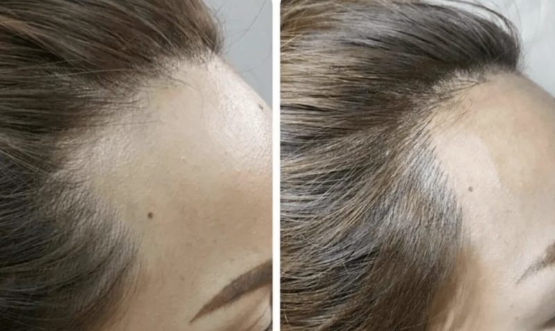 Татуаж головы у женщин фото до и после